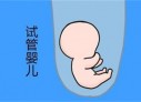 培养兰州捐卵宝宝艺术细胞的小技巧